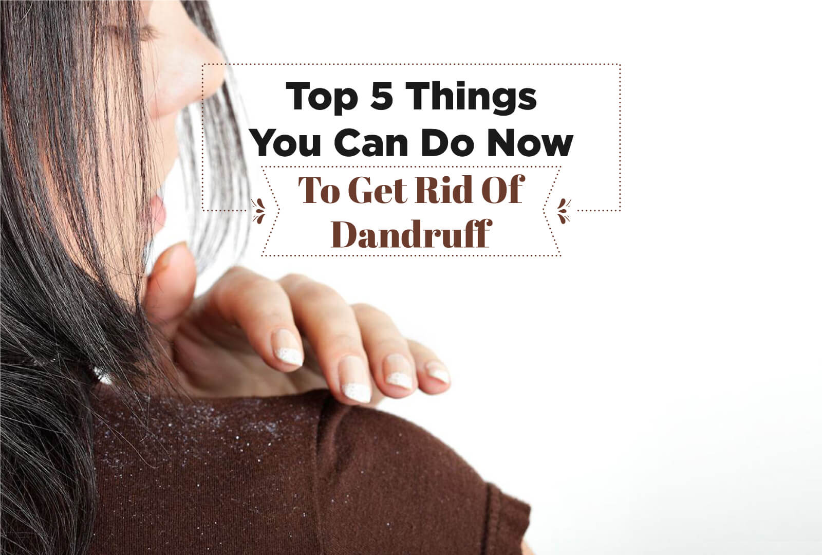 THE TOP 5 THINGS YOU CAN DO NOW TO GET RID OF DANDRUFF